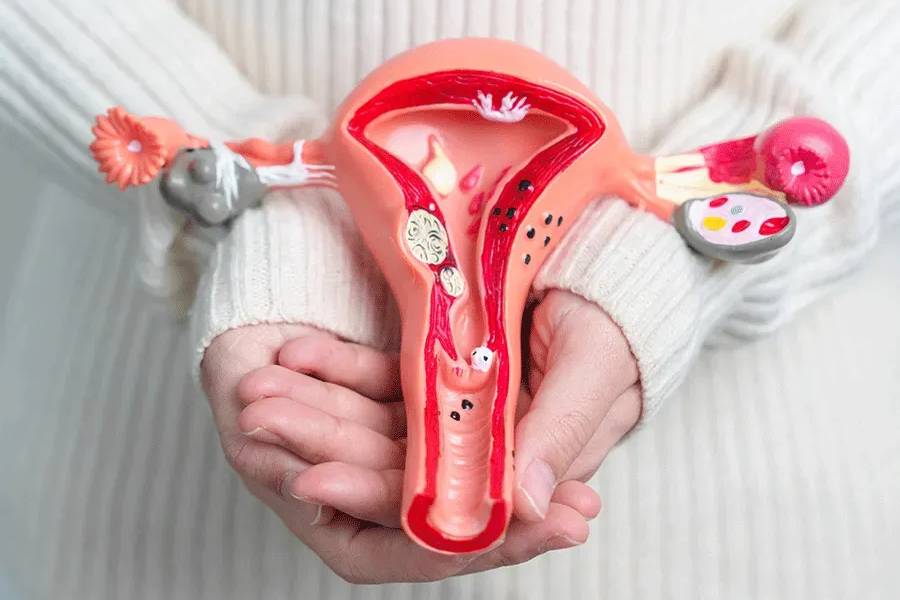 Uterine Fibroids Treatment in Ravet, Pune – Dr. Dipak S. Kolte performing laparoscopic fibroid removal at Kolte Hospital.