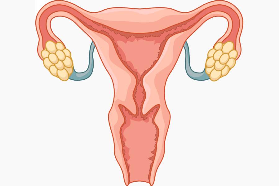 Endometriosis Treatment in Pune at Kolte Hospital – Advanced Laparoscopic Surgery by Dr. Dipak S. Kolte, Best Endometriosis Specialist in PCMC, Ravet