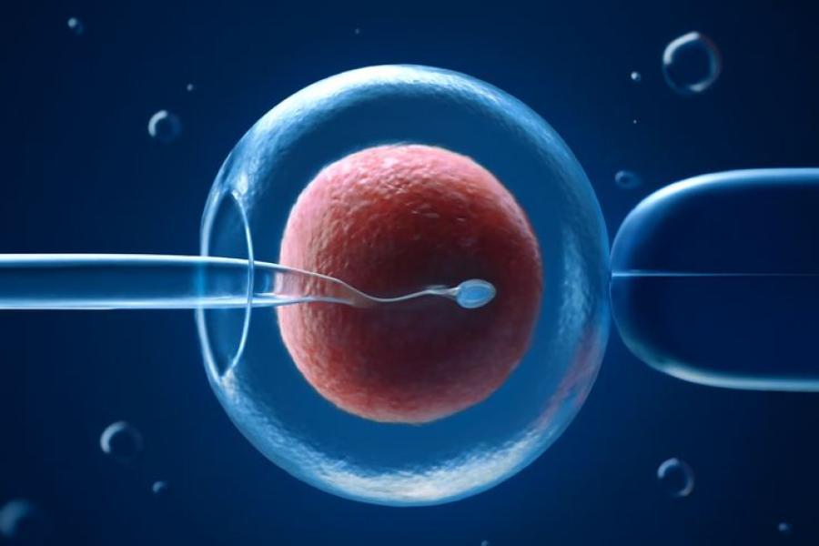 ICSI procedure injecting single sperm into egg for fertilization
