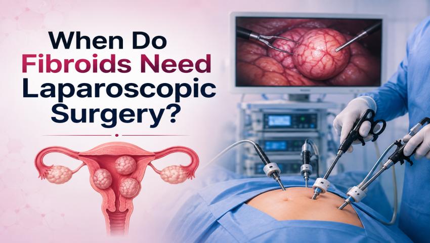 When do fibroids need laparoscopic surgery for safe removal infographics